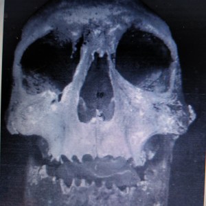 Cráneo de Bermudo III